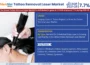 Tattoo Removal Laser Market